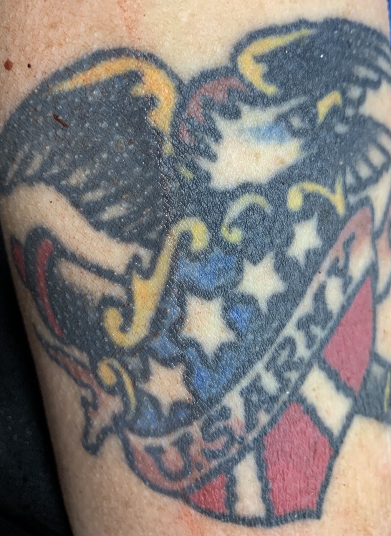 NamUs UP105481 — Located on right bicep